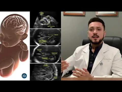Video: ¿Qué es el ultrasonido estructural o del segundo trimestre del embarazo?