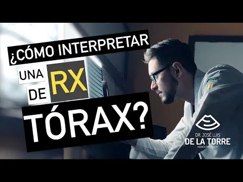 Video: ¿Cómo interpretar una radiografía de tórax?
