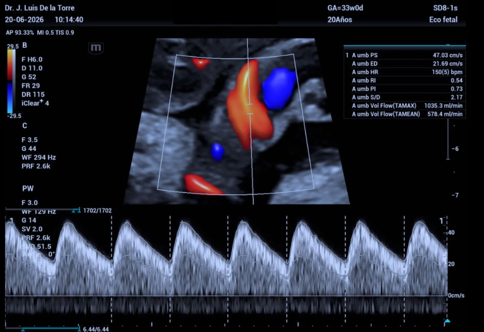 Ultrasonido de Crecimiento Fetal